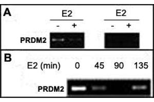 A : Soluble chromatin was prepared from MCF-7 cells not treated or treated with E2 for 45 min. (PRDM2 Antikörper  (AA 1-347))