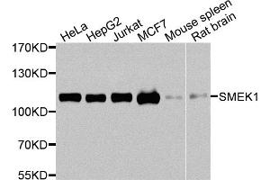Western blot analysis of extracts of various cell lines, using SMEK1 antibody. (SMEK1 Antikörper)