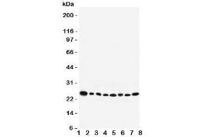 Western blot testing of Rab8 antibody and Lane 1:  rat brain;  2: mouse brain;  3: human placenta;  4: (h) HeLa;  5: (r) PC12;  6: (m) NIH3T3;  7: (h) A431;  8: (h) 293T lysate. (RAB8A Antikörper  (C-Term))