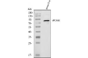 Western blot analysis of BCHE using anti-BCHE antibody (ABIN3042329).