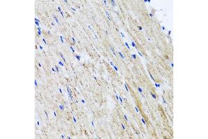 Immunohistochemistry of paraffin-embedded mouse heart using HY antibody  at dilution of 1:100 (40x lens).