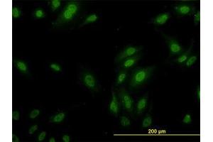 Image no. 3 for anti-Ribosomal Protein L9 (RPL9) (AA 93-192) antibody (ABIN598584) (RPL9 Antikörper  (AA 93-192))