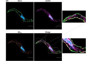 Representative mid-cell section of a mesenteric artery smooth muscle cell stained for wheat germ agglutinin (WGA, green), (P)RR (purple), and BKCa channel (cat.