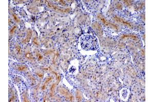 Immunohistochemistry (IHC) image for anti-Endoglin (ENG) (AA 27-226) antibody (ABIN5518982)