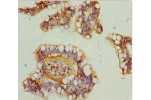 Immunohistochemistry of paraffin-embedded human small intestine tissue using ABIN7160913 at dilution of 1:100 (NDUFA9 Antikörper  (AA 1-270))