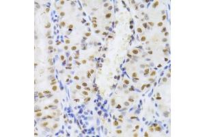 Immunohistochemistry of paraffin-embedded human stomach using XRCC5 Antibody (ABIN5973473) at dilution of 1/100 (40x lens). (XRCC5 Antikörper)