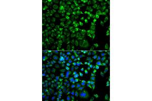 Immunofluorescence analysis of A549 cell using ZAK antibody. (ZAK Antikörper)