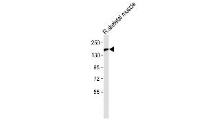 Western Blotting (WB) image for anti-BCL6 Corepressor-Like 1 (BCORL1) (AA 69-98), (N-Term) antibody (ABIN654801)