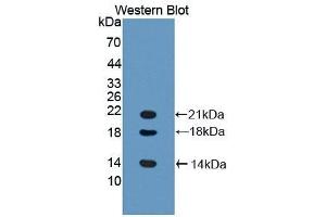 Detection of Recombinant LYAR, Mouse using Polyclonal Antibody to Ly1 Antibody Reactive Homolog (LYAR) (LYAR Antikörper  (AA 270-388))