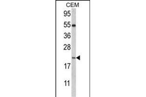 Western blot analysis of NANOS2 Antibody (C-term) (ABIN389197 and ABIN2839360) in CEM cell line lysates (35 μg/lane). (NANOS2 Antikörper  (C-Term))