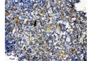 Immunohistochemistry (IHC) image for anti-Toll-Like Receptor 7 (TLR7) antibody (ABIN4952861)