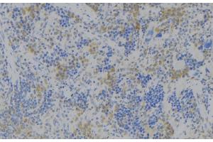 ABIN6272366 at 1/100 staining Human lymph node tissue by IHC-P.