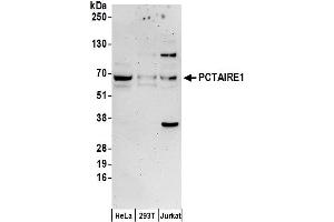 Western Blotting (WB) image for anti-Cyclin-Dependent Kinase 16 (CDK16) (AA 25-75) antibody (ABIN7450549)