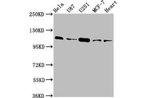 Western Blot Positive WB detected in: Hela whole cell lysate, U87 whole cell lysate, U251 whole cell lysate, MCF-7 whole cell lysate, Rat heart tissue All lanes: ANO2 antibody at 3. (Anoctamin 2 Antikörper  (AA 1-83))