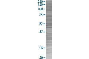 BIRC2 transfected lysate.