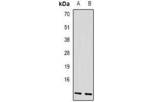 Western blot analysis of AP3-beta-1 expression in SKOV3 (A), mouse liver (B) whole cell lysates. (AP3B1 Antikörper)