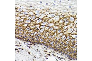 Immunohistochemistry of paraffin-embedded Human normal cervix using CD44 antibody  at dilution of 1:100 (40x lens). (CD44 Antikörper)