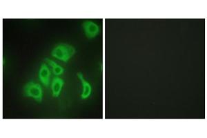 Immunofluorescence analysis of HepG2 cells, using TNF alpha antibody. (TNF alpha Antikörper  (Internal Region))