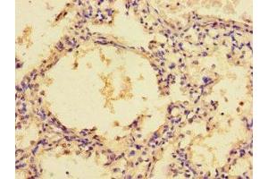 Immunohistochemistry of paraffin-embedded human lung tissue using ABIN7176741 at dilution of 1:100 (ZG16 Antikörper  (AA 17-167))