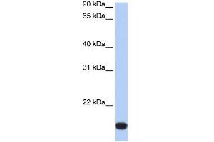 WB Suggested Anti-FLJ44894 Antibody Titration:  0. (FLJ44894 Antikörper  (Middle Region))