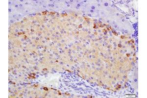 Formalin-fixed and paraffin embedded mouse pancreas labeled with Rabbit Anti-ATG1/ULK1 Polyclonal Antibody, Unconjugated 1:200 followed by conjugation to the secondary antibody and DAB staining (ULK1 Antikörper  (AA 951-1050))