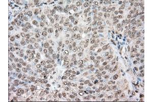 Immunohistochemical staining of paraffin-embedded Human colon tissue using anti-ACAT2 mouse monoclonal antibody. (ACAT2 Antikörper)