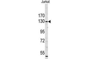 Western Blotting (WB) image for anti-Myosin IA (MYO1A) antibody (ABIN3003156) (Myosin IA Antikörper)