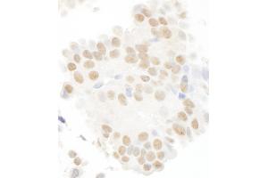 Immunohistochemistry (IHC) image for anti-Microtubule Associated serine/threonine Kinase-Like (MASTL) (AA 550-600) antibody (ABIN7448641) (MASTL Antikörper  (AA 550-600))