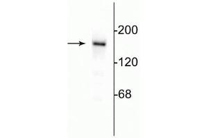 Western blot of 10 µg of rat hippocampal lysate showing specific immunolabeling of the ~180 kDa NR2B subunit of the NMDA receptor. (GRIN2B Antikörper  (C-Term))