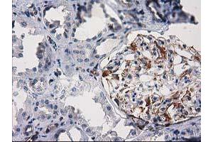 Immunohistochemical staining of paraffin-embedded Human Kidney tissue using anti-PDE2A mouse monoclonal antibody. (PDE2A Antikörper)