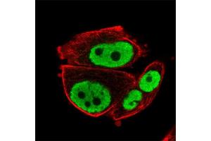 Immunofluorescent staining of human cell line PC-3 with RARG polyclonal antibody  at 1-4 ug/mL concentration shows positivity in nucleus but excluded from the nucleoli. (Retinoic Acid Receptor gamma Antikörper)