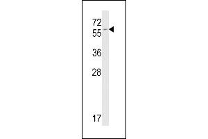 FKBP9 antibody  (C-Term)
