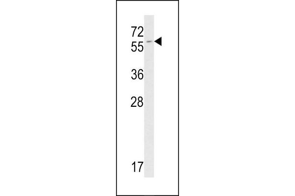 FKBP9 antibody  (C-Term)