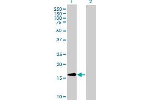 Western Blot analysis of CLUHP3 expression in transfected 293T cell line ( H00079014-T02 ) by CLUHP3 MaxPab polyclonal antibody. (CLUHP3 Antikörper  (AA 1-147))