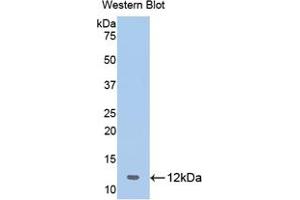 Western blot analysis of the recombinant protein. (OAS1 Antikörper  (AA 74-165))