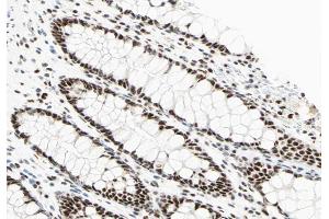 ABIN6266603 at 1/100 staining human colon tissue sections by IHC-P.