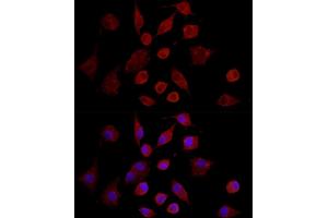 Immunofluorescence (IF) image for anti-Matrix Metallopeptidase 7 (Matrilysin, Uterine) (MMP7) (AA 18-267) antibody (ABIN3021103)