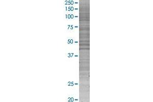 MS4A2 transfected lysate. (MS4A2 293T Cell Transient Overexpression Lysate(Denatured))