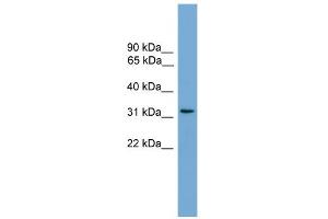 WB Suggested Anti-CCDC117 Antibody Titration: 0. (CCDC117 Antikörper  (Middle Region))