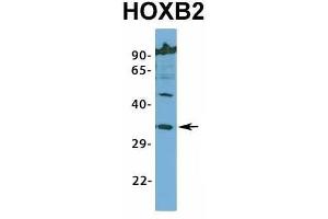Host:  Rabbit  Target Name:  HOXB2  Sample Type:  Jurkat  Antibody Dilution:  1. (HOXB2 Antikörper  (N-Term))