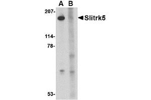Image no. 1 for anti-SLIT and NTRK-Like Family, Member 5 (SLITRK5) (Internal Region) antibody (ABIN1493808) (SLITRK5 Antikörper  (Internal Region))