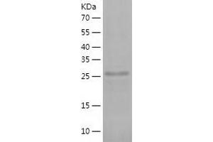 Western Blotting (WB) image for Phosphatidylinositol Transfer Protein, Membrane-Associated 2 (PITPNM2) (AA 162-435) protein (His tag) (ABIN7284168) (PITPNM2 Protein (AA 162-435) (His tag))