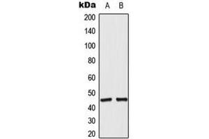 Western blot analysis of ACOT4 expression in RT4 (A), A549 (B) whole cell lysates. (ACOT4 Antikörper  (C-Term))