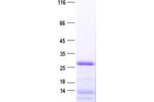 Validation with Western Blot (RPL10A Protein (full length) (His tag))