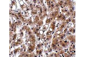 Immunohistochemistry of THEM4 in human liver tissue with THEM4 polyclonal antibody  at 2.