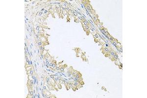 Immunohistochemistry of paraffin-embedded human prostate using PPP3R1 antibody at dilution of 1:100 (x40 lens). (PPP3R1 Antikörper)