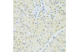 Immunohistochemistry of paraffin-embedded rat pancreas using BRCA1 antibody (ABIN6291827) at dilution of 1:100 (40x lens). (BRCA1 Antikörper)