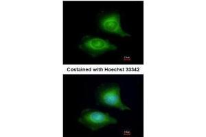 ICC/IF Image Immunofluorescence analysis of methanol-fixed HeLa, using LZTFL1, antibody at 1:200 dilution. (LZTFL1 Antikörper)