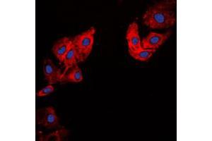 Immunofluorescent analysis of Collagen 5 alpha 1 staining in HeLa cells. (COL5A1 Antikörper  (Center))