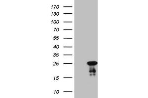 Western Blotting (WB) image for anti-ATP-Binding Cassette, Sub-Family C (CFTR/MRP), Member 5 (ABCC5) antibody (ABIN2715615) (ABCC5 Antikörper)